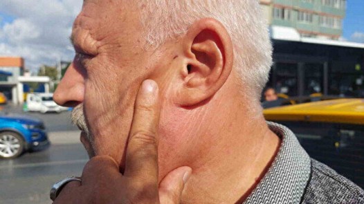 Kornaya bastı diye dehşeti yaşadı: Darp edip soymaya çalıştılar